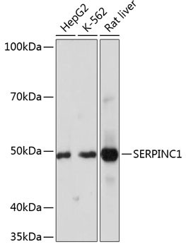 SERPINC1 Antibody in Western Blot (WB)