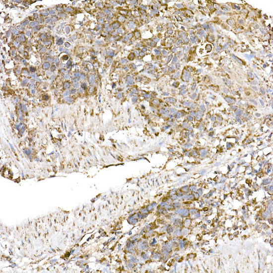 C1QBP Antibody in Immunohistochemistry (Paraffin) (IHC (P))