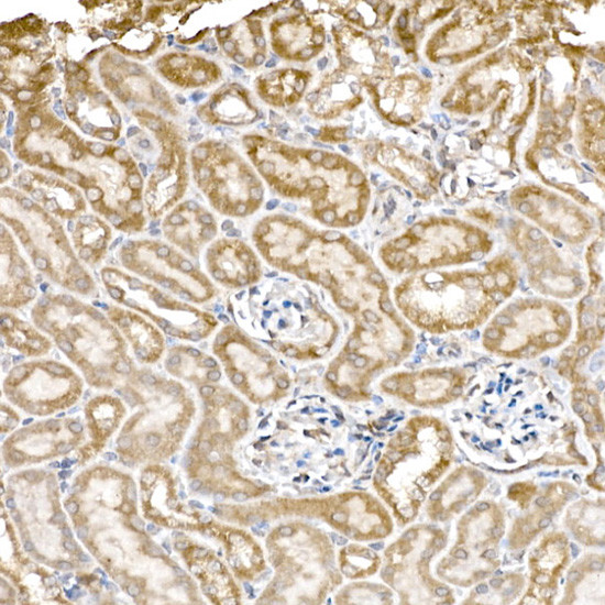 C1QBP Antibody in Immunohistochemistry (Paraffin) (IHC (P))