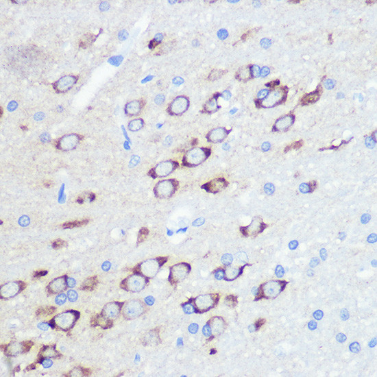 GluR2 Antibody in Immunohistochemistry (Paraffin) (IHC (P))