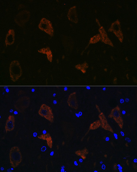 GluR2 Antibody in Immunohistochemistry (Paraffin) (IHC (P))