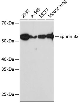 Ephrin B2 Antibody in Western Blot (WB)