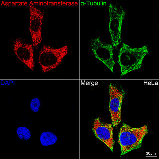 GOT1 Antibody in Immunocytochemistry (ICC/IF)