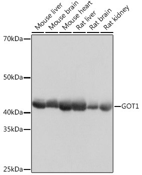 GOT1 Antibody in Western Blot (WB)