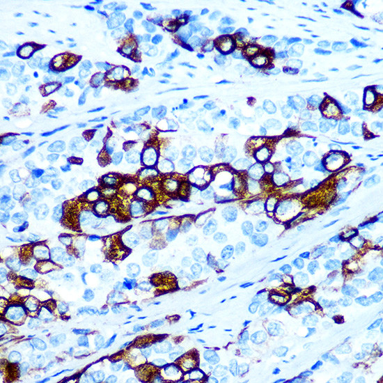 Cytokeratin 5 Antibody in Immunohistochemistry (Paraffin) (IHC (P))