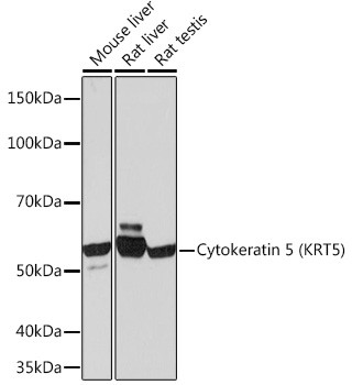 Cytokeratin 5 Antibody in Western Blot (WB)