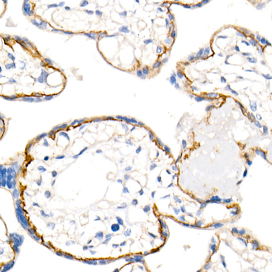 delta Catenin Antibody in Immunohistochemistry (Paraffin) (IHC (P))