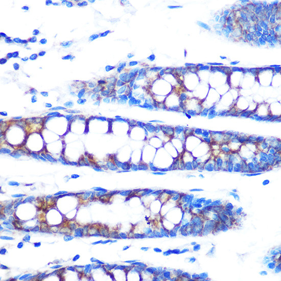 BMP4 Antibody in Immunohistochemistry (Paraffin) (IHC (P))