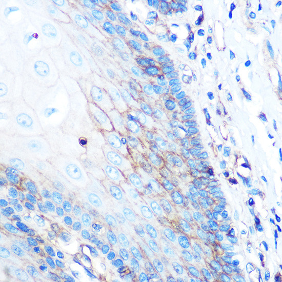 HLA-A Antibody in Immunohistochemistry (Paraffin) (IHC (P))