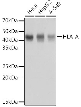 HLA-A Antibody in Western Blot (WB)