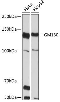 GM130 Antibody in Western Blot (WB)