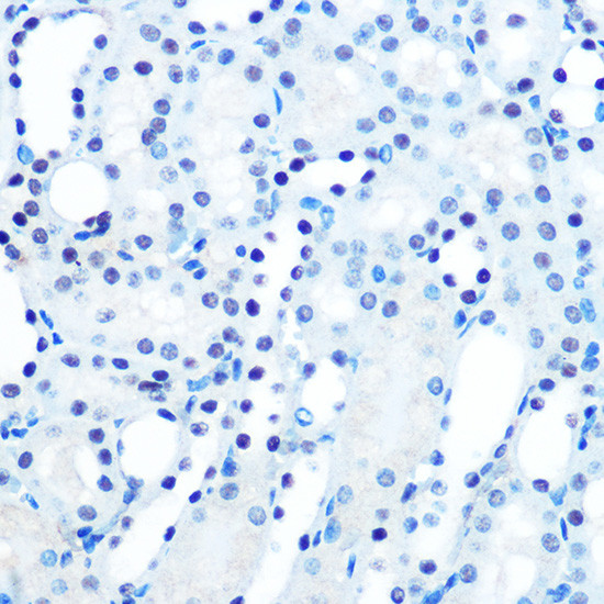 MAD2 Antibody in Immunohistochemistry (Paraffin) (IHC (P))