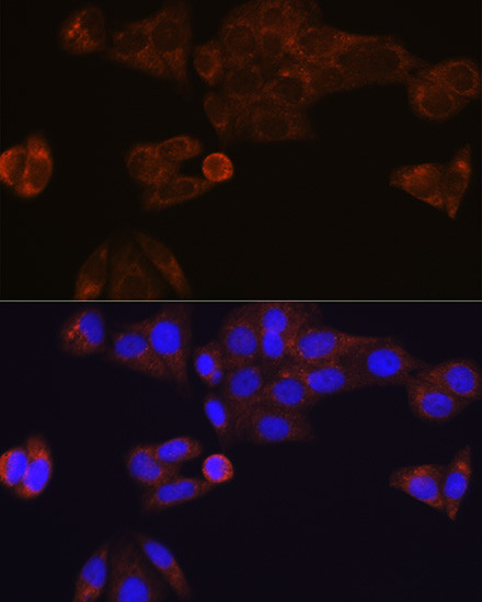 CES1 Antibody in Immunocytochemistry (ICC/IF)