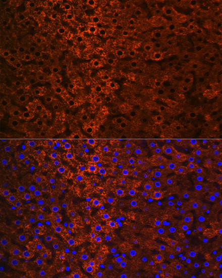 CES1 Antibody in Immunohistochemistry (Paraffin) (IHC (P))