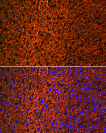 CES1 Antibody in Immunohistochemistry (Paraffin) (IHC (P))