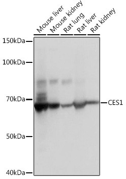 CES1 Antibody in Western Blot (WB)