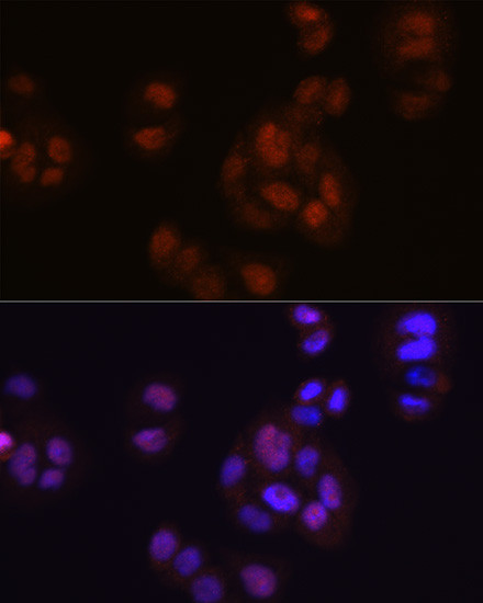 FGF2 Antibody in Immunocytochemistry (ICC/IF)