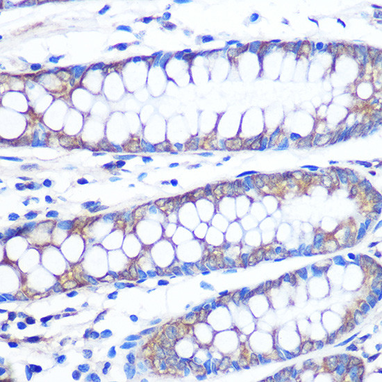 FGF2 Antibody in Immunohistochemistry (Paraffin) (IHC (P))