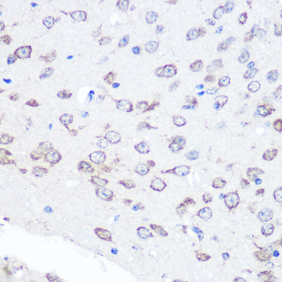 FGF2 Antibody in Immunohistochemistry (Paraffin) (IHC (P))