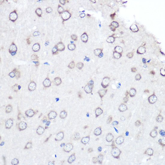 FGF2 Antibody in Immunohistochemistry (Paraffin) (IHC (P))