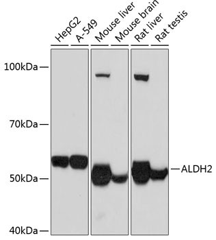 ALDH2 Antibody in Western Blot (WB)