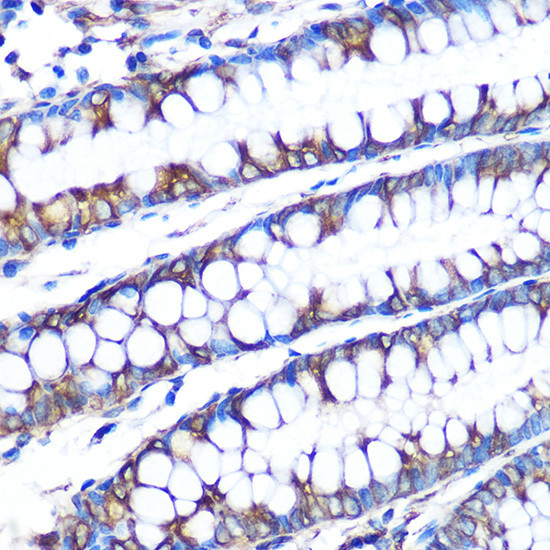 LOX Antibody in Immunohistochemistry (Paraffin) (IHC (P))