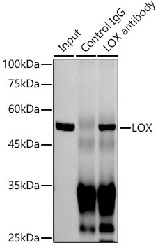 LOX Antibody in Immunoprecipitation (IP)