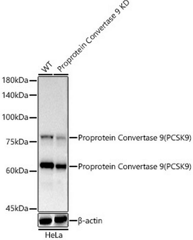 PCSK9 Antibody