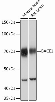 BACE1 Antibody in Western Blot (WB)