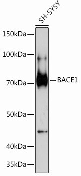 BACE1 Antibody in Western Blot (WB)