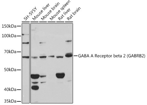 GABRB2 Antibody in Western Blot (WB)