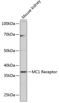 MC1R Antibody in Western Blot (WB)