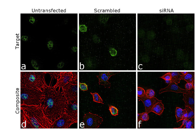 CtBP1 Antibody in Immunocytochemistry (ICC/IF)