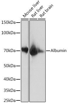 Albumin Antibody in Western Blot (WB)