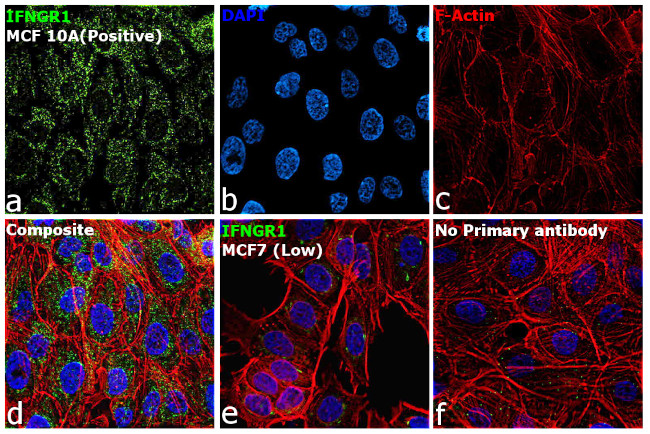 IFNGR1 Antibody in Immunocytochemistry (ICC/IF)