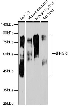 IFNGR1 Antibody in Western Blot (WB)