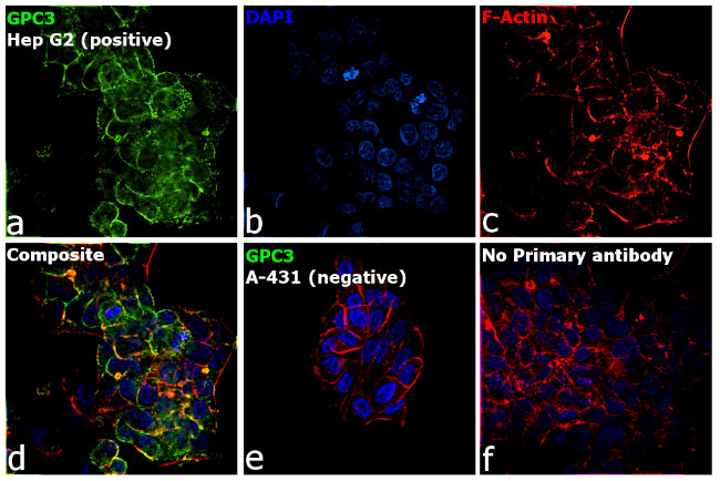 Glypican 3 Antibody