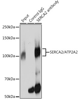 SERCA2 ATPase Antibody in Immunoprecipitation (IP)