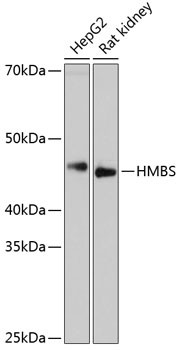 HMBS Antibody in Western Blot (WB)