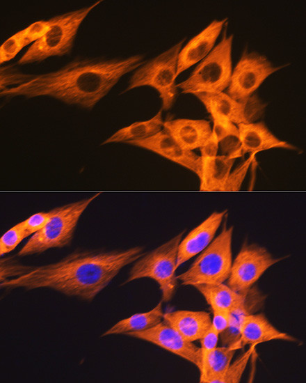 beta Tubulin Antibody in Immunocytochemistry (ICC/IF)