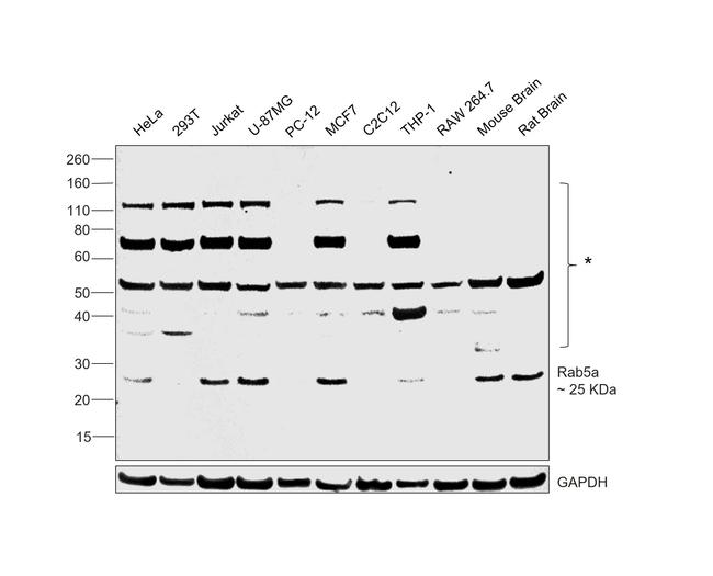 RAB5 Antibody in Western Blot (WB)