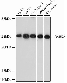 RAB5 Antibody in Western Blot (WB)