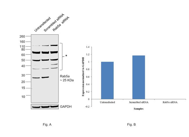 RAB5 Antibody in Western Blot (WB)