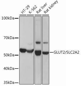 GLUT2 Antibody in Western Blot (WB)