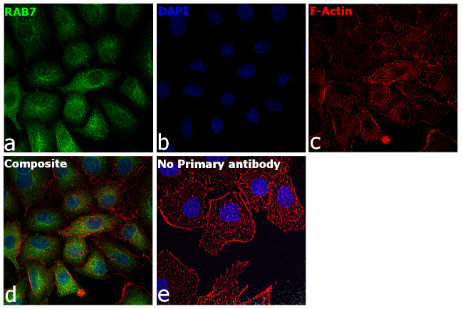 RAB7 Antibody in Immunocytochemistry (ICC/IF)