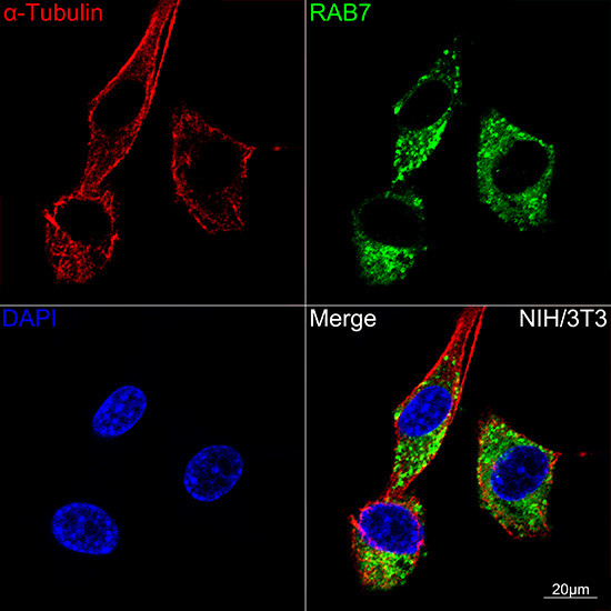 RAB7 Antibody in Immunocytochemistry (ICC/IF)