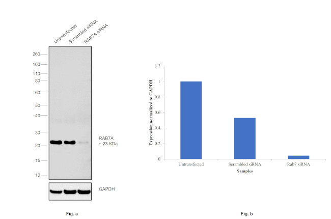 RAB7 Antibody