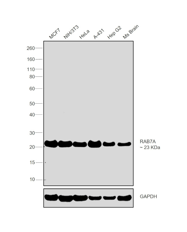 RAB7 Antibody in Western Blot (WB)