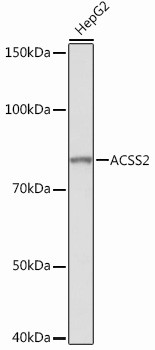 ACSS2 Antibody in Western Blot (WB)