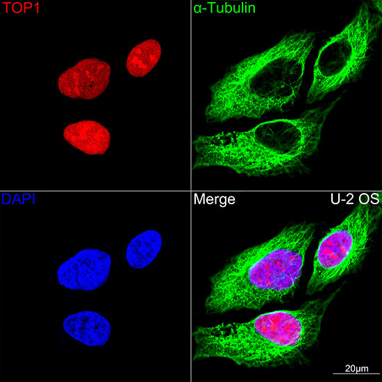 TOP1 Antibody in Immunocytochemistry (ICC/IF)